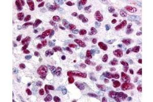 Immunohistochemistry of Rabbit anti-Gli-3 antibody. (GLI3 antibody  (AA 30-60))