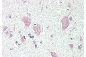 Rabbit Anti-DLG2 antibody  Formalin Fixed Paraffin Embedded Tissue: Human Brain, Cortex Primary antibody Concentration: 1:100 Secondary Antibody: Donkey anti-Rabbit-Cy3 Secondary Antibody Concentration: 1:200 Magnification: 20x Exposure Time: 0.