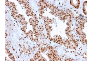 Immunohistochemistry (IHC) image for anti-Protein-tyrosine Phosphatase 1C (PTPN6) antibody (ABIN6939660)