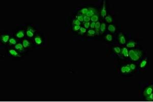 Immunofluorescent analysis of PC-3 cells using ABIN7172035 at dilution of 1:100 and Alexa Fluor 488-congugated AffiniPure Goat Anti-Rabbit IgG(H+L) (TXNL4A antibody  (AA 1-142))