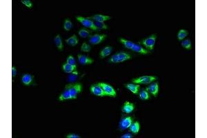 Immunofluorescent analysis of HepG2 cells using ABIN7171798 at dilution of 1:100 and Alexa Fluor 488-congugated AffiniPure Goat Anti-Rabbit IgG(H+L) (SLC26A8 antibody  (AA 414-595))