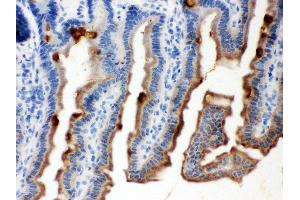 Immunohistochemistry (IHC) image for anti-serpin Peptidase Inhibitor, Clade B (Ovalbumin), Member 5 (SERPINB5) (AA 1-350) antibody (ABIN3043330)