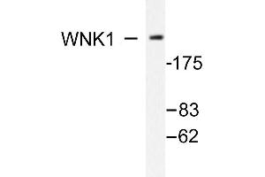 Image no. 1 for anti-WNK Lysine Deficient Protein Kinase 1 (WNK1) antibody (ABIN271862) (WNK1 antibody)