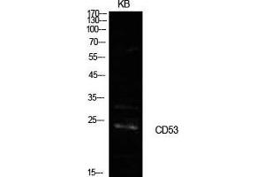 Western Blot (WB) analysis of KB cells using CD53 Polyclonal Antibody. (CD53 antibody  (Internal Region))