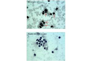 Sample type -- Oral Cell Carcinoma Dilution -- 5ug/mL (Adenosine A3 Receptor antibody  (C-Term))