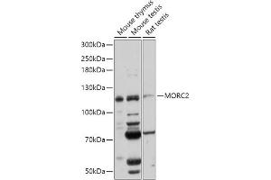 Western blot analysis of extracts of various cell lines, using MORC2 antibody (ABIN7268683) at 1:1000 dilution.