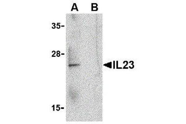 IL23 antibody  (C-Term)