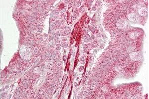 Immunohistochemistry with Small intestine tissue at an antibody concentration of 5µg/ml using anti-ROCK2 antibody (ARP61467_P050) (ROCK2 antibody  (Middle Region))