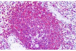 Anti-RICTOR antibody IHC staining of human spleen. (RICTOR antibody  (AA 1-99))