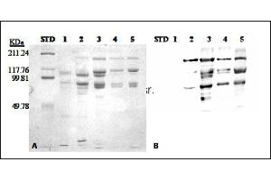 anti-Vitellogenin 2 antibody