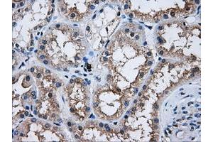Image no. 2 for anti-V-Akt Murine Thymoma Viral Oncogene Homolog 2 (AKT2) antibody (ABIN1496564) (AKT2 antibody)