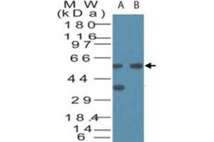Western blot analysis of VDAC2 in human brain cell lysate in the A) absence and B) presence of immunizing peptide. (VDAC2 antibody  (AA 120-132))