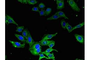 Immunofluorescent analysis of Hela cells using ABIN7146428 at dilution of 1:100 and Alexa Fluor 488-congugated AffiniPure Goat Anti-Rabbit IgG(H+L) (CAMK1 antibody  (AA 166-265))