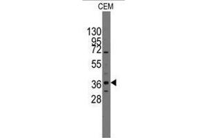 Image no. 1 for anti-Paired-Like Homeodomain 2 (PITX2) (C-Term) antibody (ABIN356913) (PITX2 antibody  (C-Term))