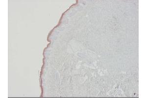 Image no. 2 for anti-Keratin 10 (KRT10) antibody (ABIN959490) (Keratin 10 antibody)