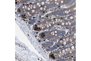 Immunohistochemical staining of human duodenum with NYAP1 polyclonal antibody  shows strong positivity in Paneth cells.