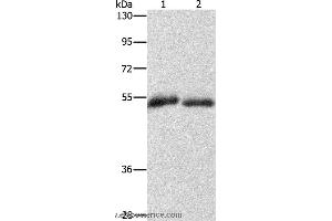 Western blot analysis of Human placenta and fat tissue, using CD36 Polyclonal Antibody at dilution of 1:1000 (CD36 antibody)