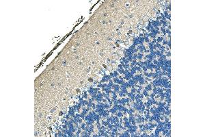 IHC analysis of Ankyrin Erythroid/ANK/ANK1 using anti-Ankyrin Erythroid/ANK/ANK1 antibody (ABIN7599959). (Erythrocyte Ankyrin antibody  (AA 1300-1844))