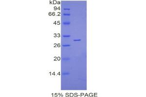 SDS-PAGE analysis of Mouse Lymphocyte Antigen 9 Protein. (LY9 Protein)