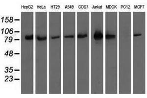 Image no. 2 for anti-Oxysterol Binding Protein-Like 11 (OSBPL11) antibody (ABIN1499922) (OSBPL11 antibody)