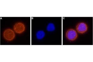 Expression of EAG1 in human MDA-468 mammary gland adenocarcinoma cells. (KCNH1 antibody  (C-Term, Intracellular))