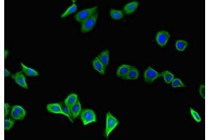 Immunofluorescent analysis of HepG2 cells using ABIN7154085 at dilution of 1:100 and Alexa Fluor 488-congugated AffiniPure Goat Anti-Rabbit IgG(H+L) (GSTA1 antibody  (AA 2-222))