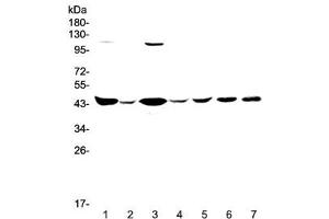 Western blot testing of human 1) HeLa, 2) placenta, 3) COLO-320, 4) SW620, 5) MDA-MB-231, 6) rat brain and 7) mouse brain lysate with CKB antibody at 0. (CKB antibody)