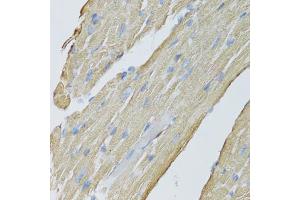 Immunohistochemistry of paraffin-embedded mouse heart using CKMT2 antibody (ABIN5975698) at dilution of 1/100 (40x lens). (CKMT2 antibody)
