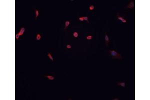 ABIN6267057 staining HT-1080 cells by IF/ICC. (Cyclin D1 antibody  (pThr286))