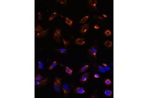 Immunofluorescence analysis of U-2 OS cells using LRRFIP2 antibody (ABIN7268214) at dilution of 1:100. (LRRFIP2 antibody  (AA 150-340))