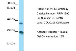 WB Suggested Anti-VSIG4 AntibodyTitration: 1. (VSIG4 antibody  (N-Term))