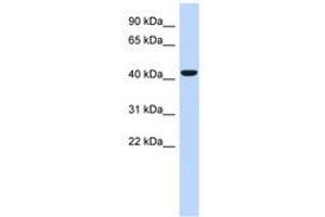 Image no. 1 for anti-Sphingomyelin Synthase 2 (SGMS2) (AA 71-120) antibody (ABIN6741219) (Sphingomyelin Synthase 2 antibody  (AA 71-120))