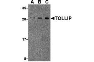 Western Blotting (WB) image for anti-Toll Interacting Protein (TOLLIP) (Middle Region) antibody (ABIN1031139)