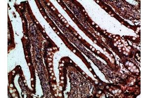 Immunohistochemical analysis of paraffin-embedded human-small-intestine, antibody was diluted at 1:200 (FABP2 antibody  (AA 90-132))