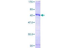 HOXC9 Protein (AA 1-260) (GST tag)