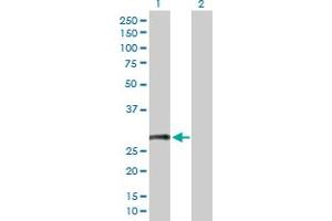 Western Blot analysis of CD8B expression in transfected 293T cell line by CD8B MaxPab polyclonal antibody. (CD8B antibody  (AA 1-243))