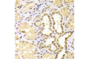 Immunohistochemistry of paraffin-embedded human kidney using S100A11 antibody. (S100A11 antibody  (AA 1-105))