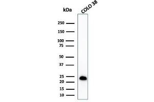 Western Blot Analysis of COLO-38 cell lysate using MART-1 Rabbit Recombinant Monoclonal Antibody (MLANA/1409R). (Recombinant MLANA antibody)
