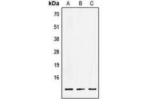 Western blot analysis of LSM2 expression in HEK293T (A), NIH3T3 (B), PC12 (C) whole cell lysates. (LSM2 antibody  (Center))