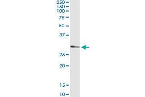 Immunoprecipitation of UCK2 transfected lysate using anti-UCK2 monoclonal antibody and Protein A Magnetic Bead , and immunoblotted with UCK2 MaxPab rabbit polyclonal antibody. (UCK2 antibody  (AA 1-261))