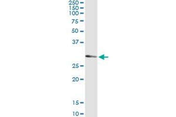 UCK2 antibody  (AA 1-261)