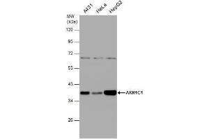 WB Image Various whole cell extracts (30 μg) were separated by 10% SDS-PAGE, and the membrane was blotted with AKR1C1 antibody , diluted at 1:1000. (AKR1C1 antibody)