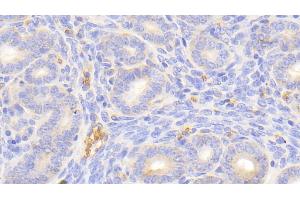 Detection of HBb in Mouse Uterus Tissue using Polyclonal Antibody to Hemoglobin Beta (HBb) (Hemoglobin Subunit beta antibody  (AA 1-147))