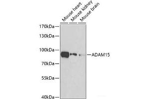 Western blot analysis of extracts of various cell lines using ADAM15 Polyclonal Antibody at dilution of 1:500. (ADAM15 antibody)