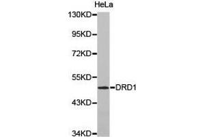 Western Blotting (WB) image for anti-Dopamine Receptor D1 (DRD1) antibody (ABIN1872351) (Dopamine Receptor d1 antibody)
