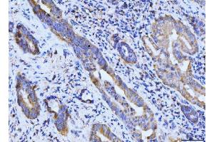 IHC analysis of BCKDK using anti-BCKDK antibody (ABIN7601470).