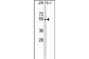 Western blot analysis in ZR-75-1 cell line lysates (35ug/lane). (Phospholipase D4 antibody  (N-Term))