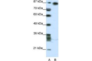 Western Blotting (WB) image for anti-Myoneurin (MYNN) antibody (ABIN2460663)