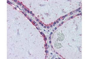 Immunohistochemistry with HeLa, Vera, HeLa transfected with mouse construct tissue (KIF20A antibody  (Middle Region))