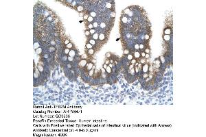 Human Intestine (TFB2M antibody  (N-Term))